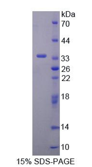 Human Recombinant Kallikrein 8 (KLK8)