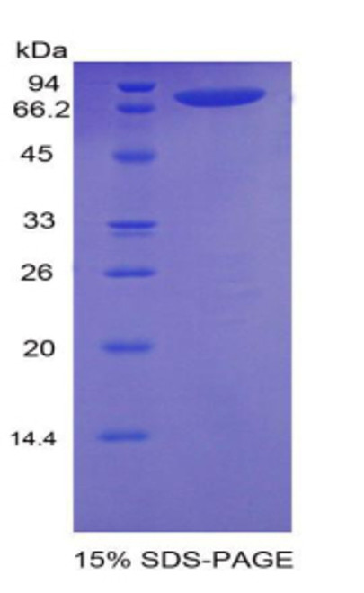 Rat Recombinant Neuropilin 1 (NRP1) Rat Recombinant Neuropilin 1 (NRP1)
