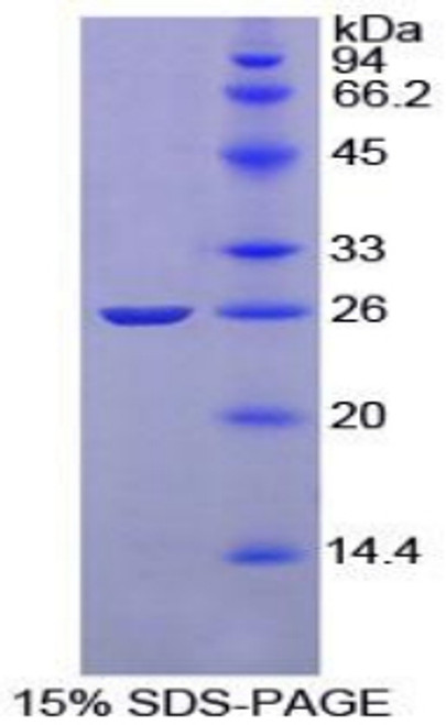 Rat Recombinant Complement Receptor 2 (CR2)