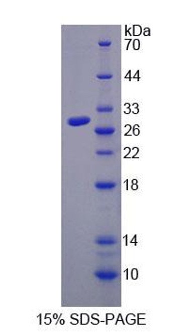 Human Recombinant Toll Like Receptor 4 (TLR4) Human Recombinant Toll Like Receptor 4 (TLR4)