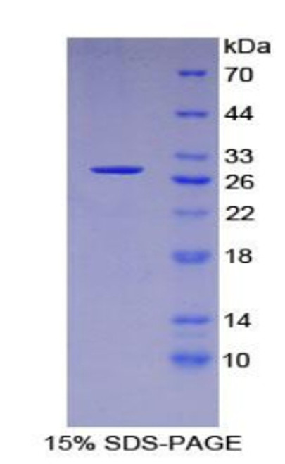 Human Recombinant Forkhead Box Protein O1 (FOXO1)