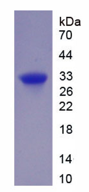 Human Recombinant Forkhead Box Protein P1 (FOXP1)