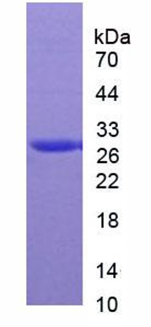 Rat Native Carbonic Anhydrase II (CA2)