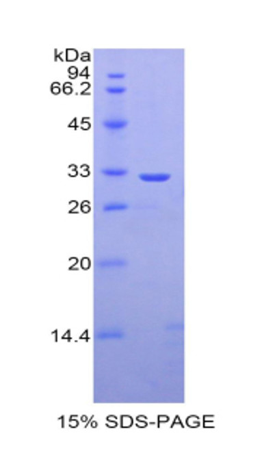 Rat Recombinant Carbonic Anhydrase II (CA2)