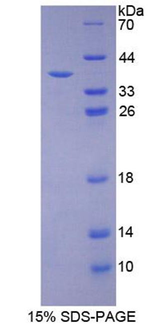 Mouse Recombinant Programmed Cell Death Protein 1 Ligand 1 (PDCD1LG1)