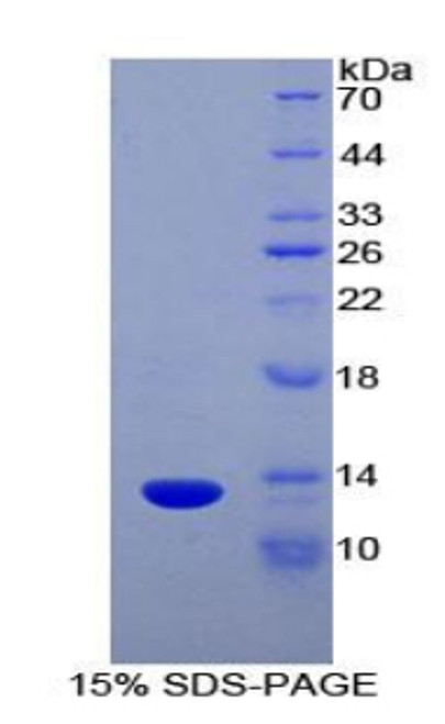 Human Recombinant Lymphotactin (Lptn)