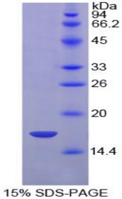 Chicken Recombinant Hypoxia Inducible Factor 1 Alpha (HIF1a)