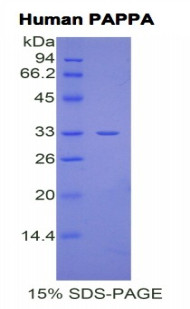 Human Recombinant Pregnancy Associated Plasma Protein A (PAPPA)