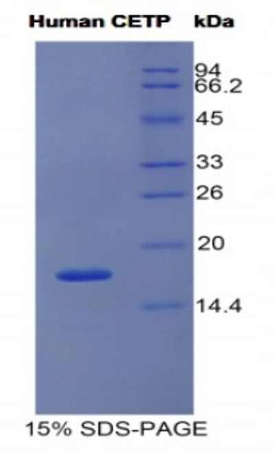 Human Recombinant Cholesteryl Ester Transfer Protein (CETP) Human Recombinant Cholesteryl Ester Transfer Protein (CETP)