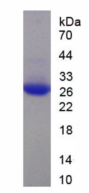 Human Recombinant Nitric Oxide Synthase 1, Neuronal (NOS1)