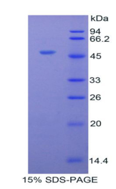 Cattle Recombinant Alpha-1-Acid Glycoprotein (a1AGP)