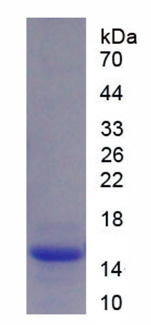 Human Recombinant Haptoglobin (Hpt)