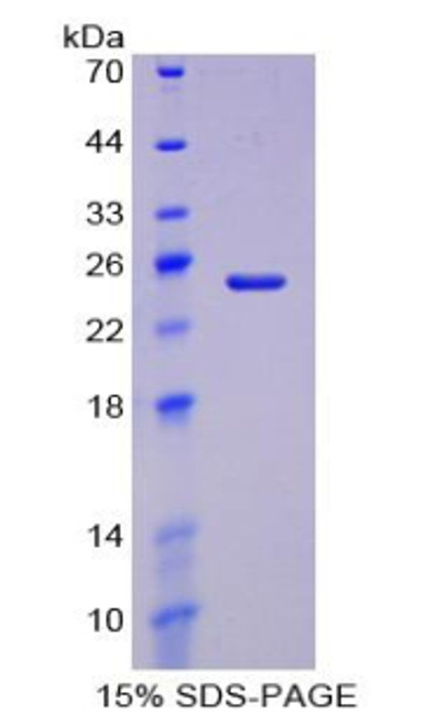 Pig Recombinant Haptoglobin (Hpt)