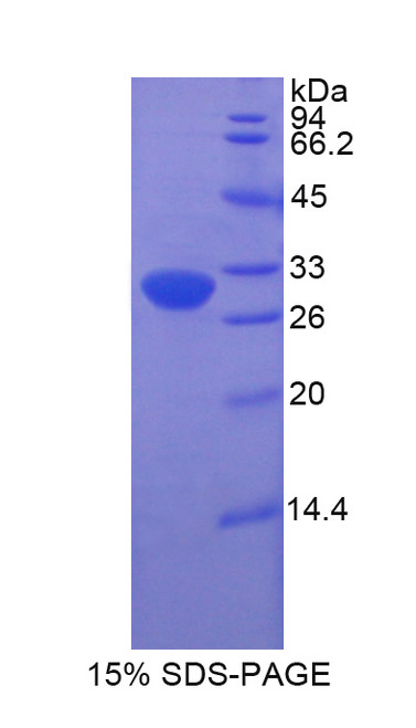 Rat Recombinant Haptoglobin Related Protein (HPR)