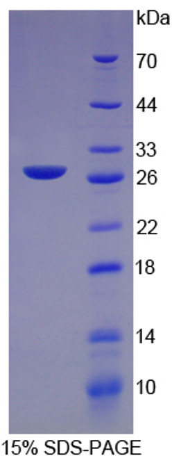 Rat Recombinant C Reactive Protein (CRP)