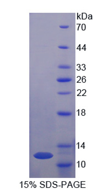 Rat Recombinant Von Willebrand Factor (vWF)