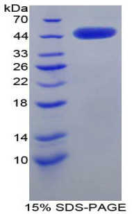 Rat Recombinant Corticotropin Releasing Hormone (CRH)