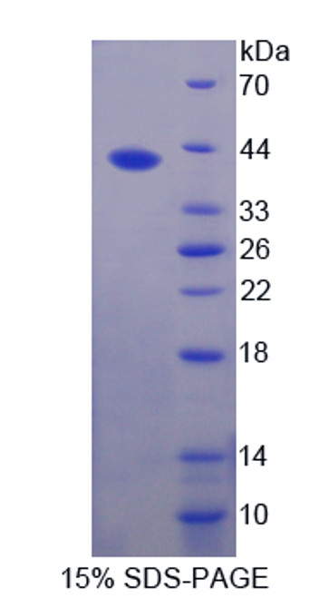 Cattle Recombinant Resistin (RETN)