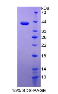 Human Recombinant Epithelial Neutrophil Activating Peptide 78 (ENA78)