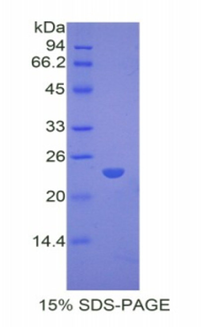 Rabbit Recombinant Peroxisome Proliferator Activated Receptor Gamma (PPARg)