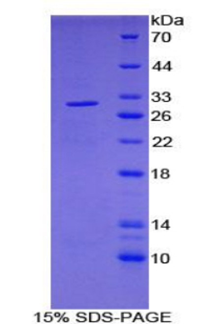 Human Recombinant Pyruvate Dehydrogenase Phosphatase (PDP)