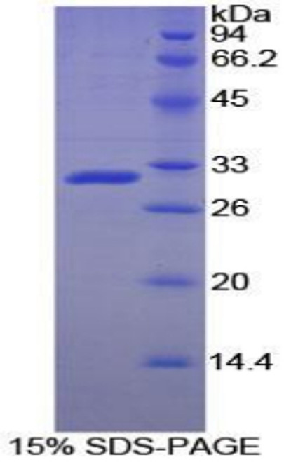 Rat Recombinant Acid Phosphatase 5, Tartrate Resistant (ACP5)