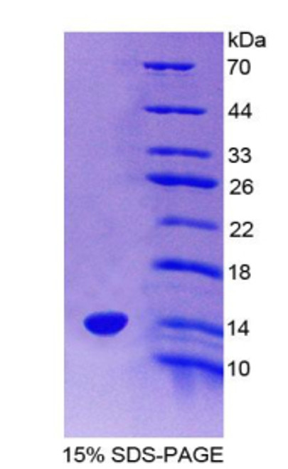 Rat Recombinant Pre-B-Lymphocyte Gene 1 (VPREB1)