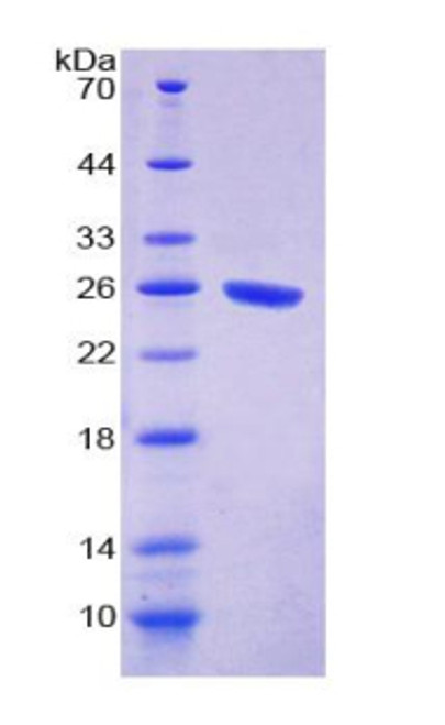 Rat Recombinant Signal Regulatory Protein Alpha (SIRPa)