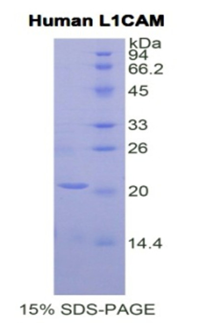 Human Recombinant L1-Cell Adhesion Molecule (L1CAM)