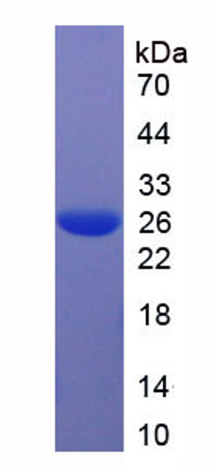 Human Recombinant Sialic Acid Binding Ig Like Lectin 1 (SIGLEC1)