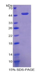 Human Recombinant Activin A Receptor Type I (ACVR1)