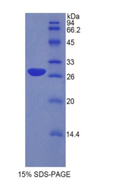 Human Recombinant Protein Zero, Myelin (MPZ)