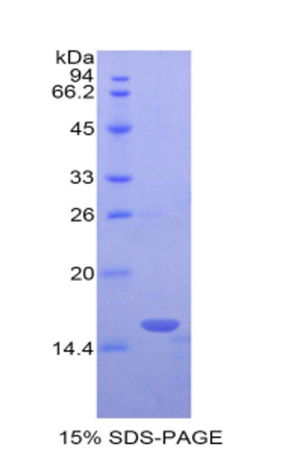 Human Recombinant Leukocyte Associated Immunoglobulin Like Receptor 2 (LAIR2)