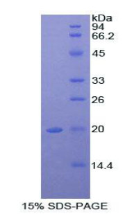 Mouse Recombinant Alpha-2-Macroglobulin (a2M)