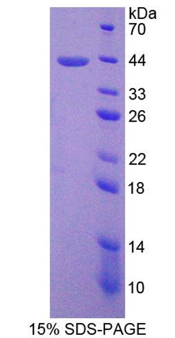 Human Recombinant Surfactant Associated Protein D (SPD)