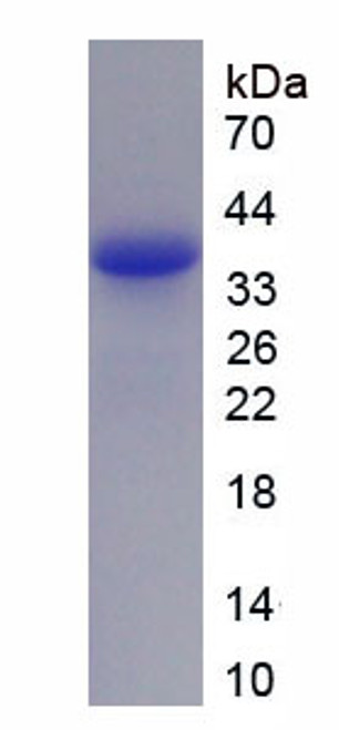 Rat Recombinant Cytochrome P450 7A1 (CYP7A1)