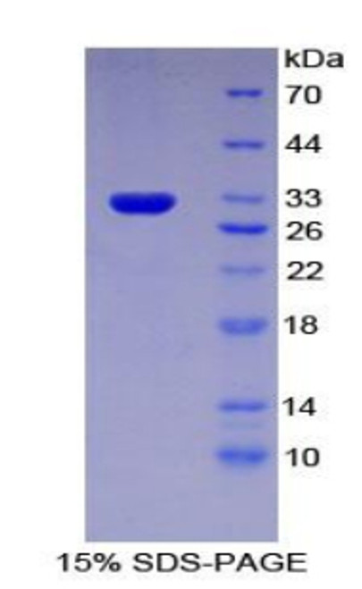 Mouse Recombinant Multidrug Resistance Associated Protein 1 (MRP1)