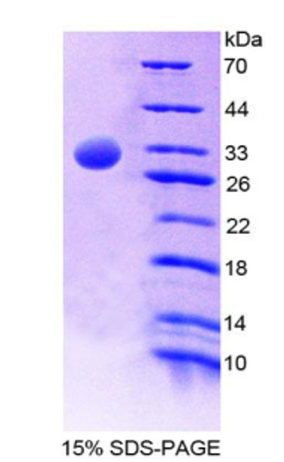 Human Recombinant General Transcription Factor IIH, Polypeptide 1 (GTF2H1)