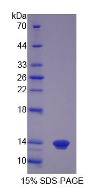 Pig Recombinant S100 Calcium Binding Protein A12 (S100A12)
