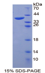 Human Recombinant Heat Shock 70kDa Protein 1A (HSPA1A)