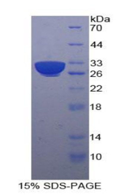 Human Recombinant Heat Shock 70kDa Protein 9 (HSPA9)