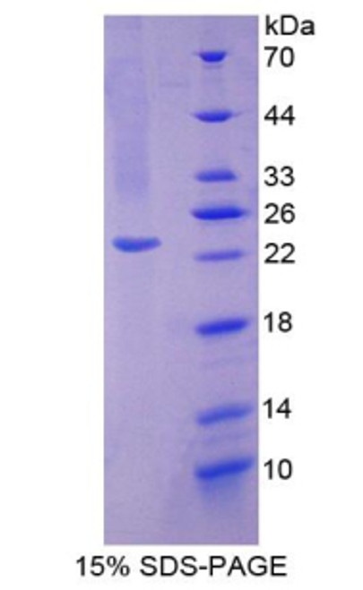 Mouse Recombinant Superoxide Dismutase 2, Mitochondrial (SOD2)