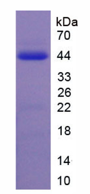 Rat Recombinant Galanin (GAL)