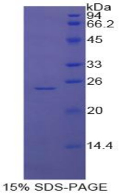 Cattle Recombinant Glutathione S Transferase Pi (GSTp)