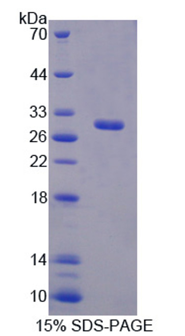 Mouse Recombinant Brain Finger Protein (BFP)