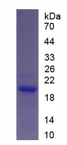 Human Recombinant Glucose Transporter 1 (GLUT1)