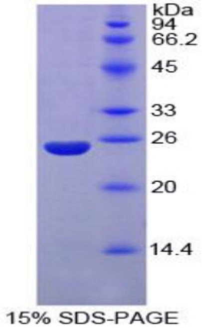 Mouse Recombinant Nucleoporin 160kDa (NUP160)