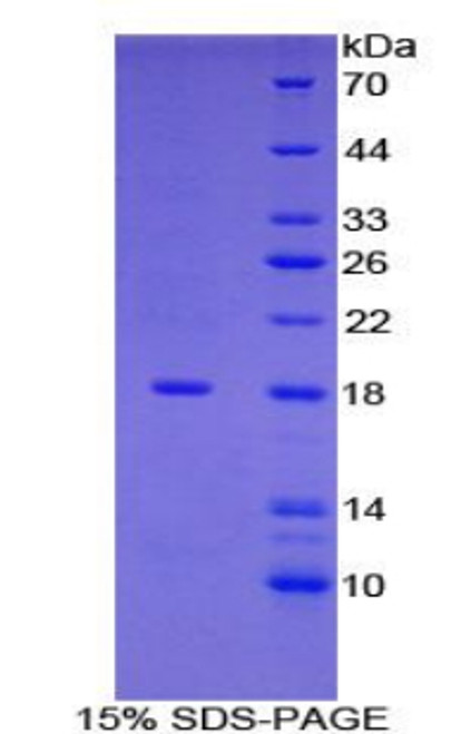 Human Recombinant Glia Maturation Factor Gamma (GMFg)