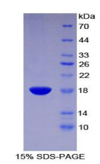 Mouse Recombinant Glia Maturation Factor Gamma (GMFg)