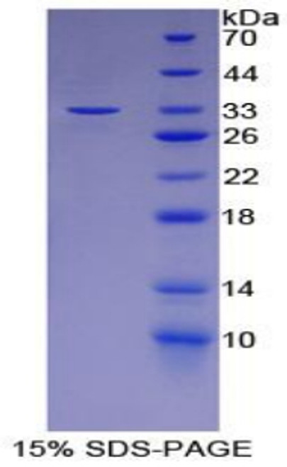 Mouse Recombinant Lymphocyte Cytosolic Protein 2 (LCP2)